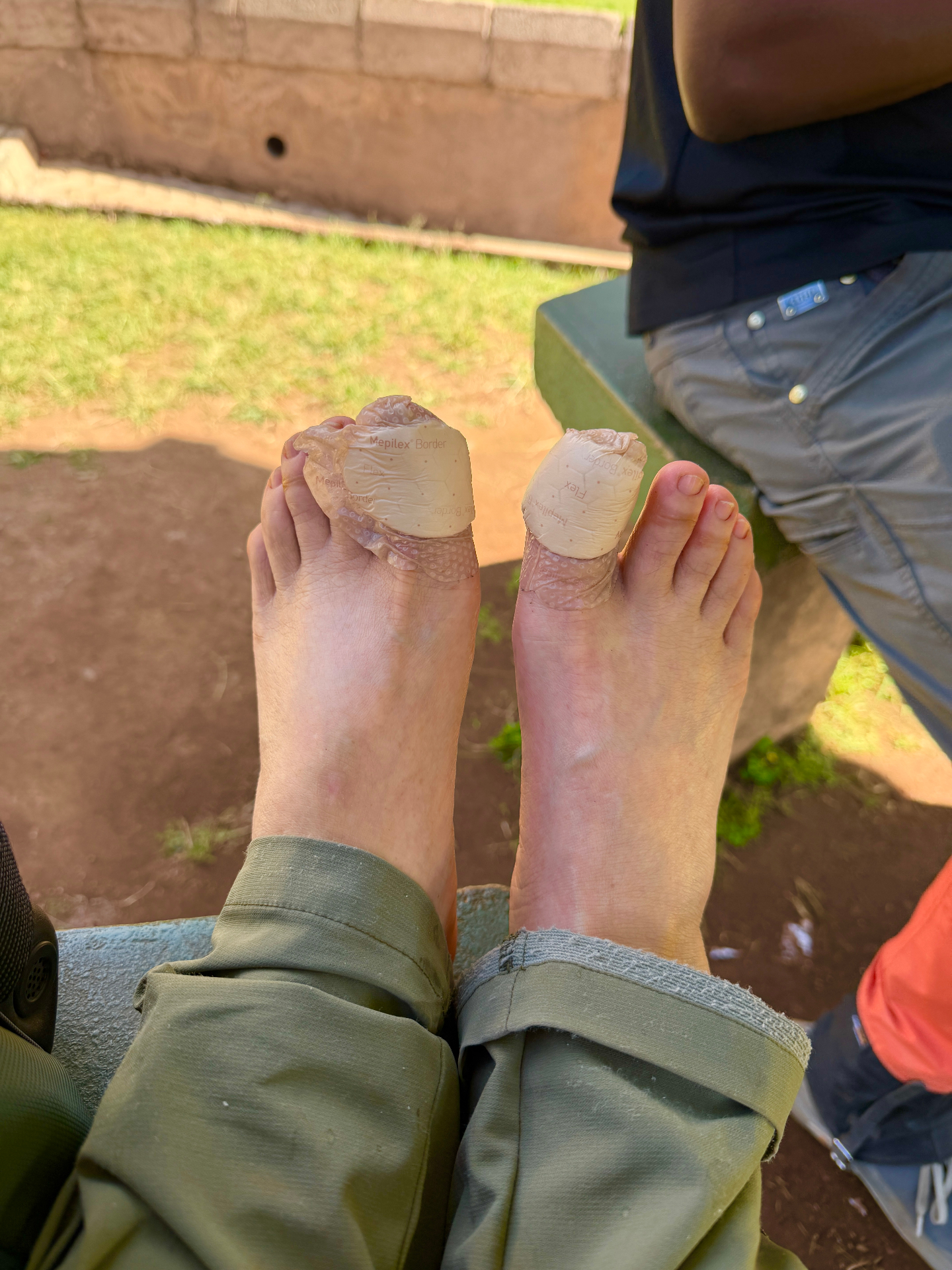 下山后的双脚恢复